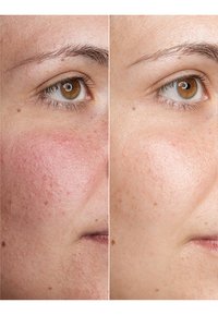 BABOR BETA-GLUCANE AMPOULE - Serum