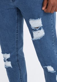 Primer plano de unos jeans de mezclilla azul con varias rasgaduras horizontales que muestran hilos blancos, usados por una persona de tono de piel oscura.