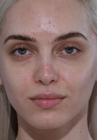 Gros plan d'un visage avec une peau claire, des yeux bleu clair, des sourcils fins et foncés, et quelques boutons légers sur le front et les joues. Texture lisse et naturelle.