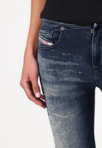 Jeans ajustados de mezclilla de un azul oscuro con detalles de desgastado en los muslos, un pequeño bolsillo delantero y una etiqueta de marca visible asomándose del bolsillo.