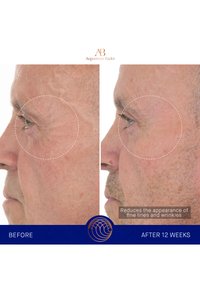 Augustinus Bader THE RETINOL SERUM - Siero