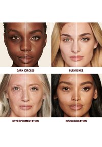 Quatre visages divers présentant des affections cutanées avant et après traitement : cernes, imperfections, hyperpigmentation et décoloration.