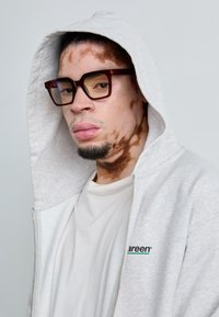 Grå zip-up hoodie med en hvid t-shirt under. Mørke stel med gule linser. Bemærkelsesværdige hudmønstre synlige på ansigtet og halsen.