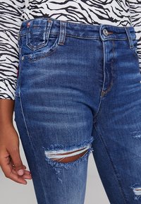 Jeans de denim azul con un acabado desgastado, presentan rasgaduras en las rodillas, diseño de cinco bolsillos y costuras en contraste.