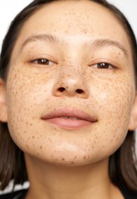 Zbliżenie na twarz z gładką cerą pokrytą licznymi brązowymi piegami, jasnobrązowymi ustami i prostymi, ciemnymi włosami.