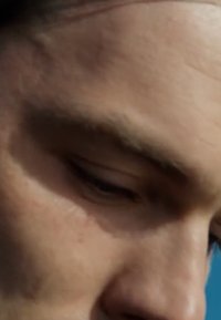 Gros plan sur un visage humain se concentrant sur le front et la région des yeux, avec un teint clair, des textures subtiles et des ridules.