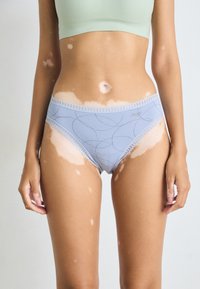 Vrouw met vitiligo in lichtblauwe, gemusterde onderbroek en een lichtgroene crop top, staande tegen een effen achtergrond.