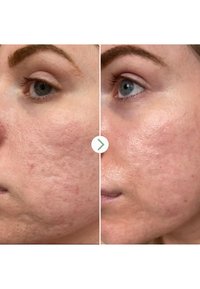 Immagine in miniatura 3