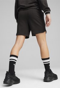 Pantalones cortos deportivos negros con una textura suave, de longitud por encima de la rodilla, combinados con calcetas a rayas en blanco y negro y zapatillas oscuras.