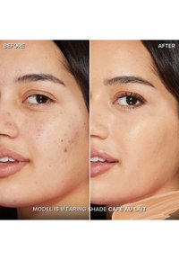 Before and after images of a model's face; skin tone shown is medium with a smooth finish. Notable blemishes are significantly reduced.