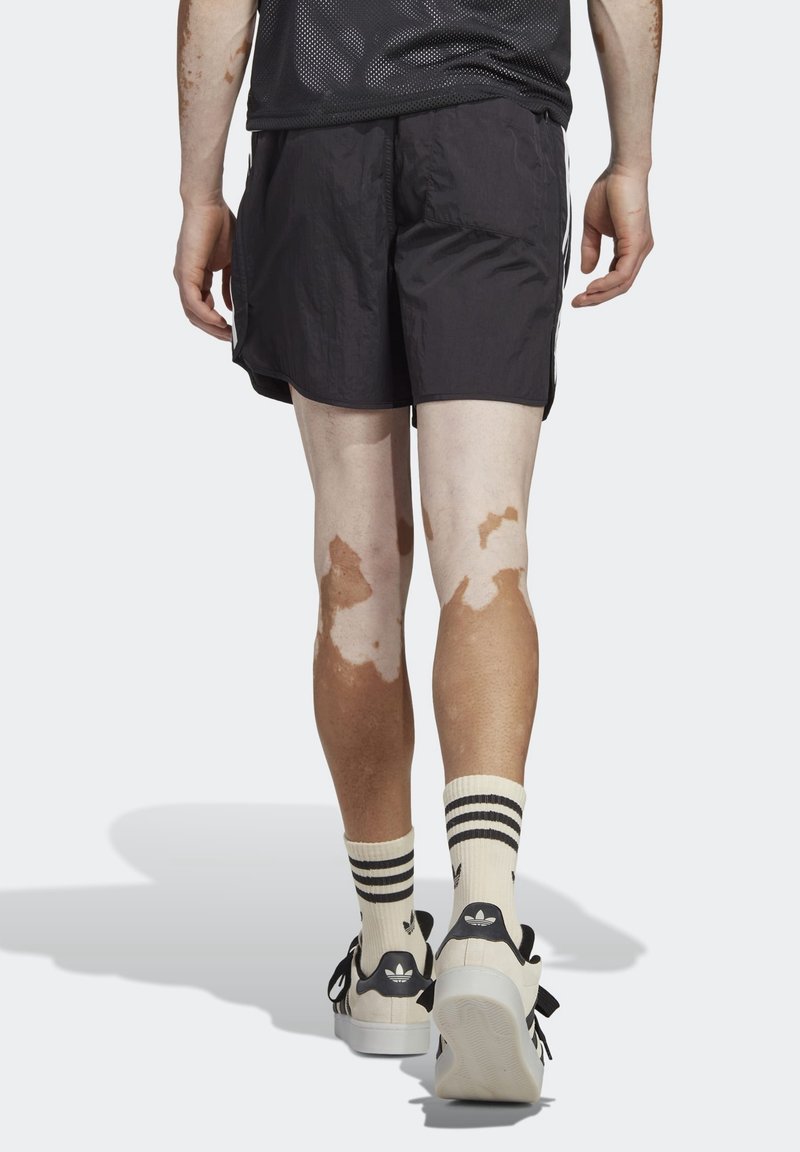 Shorts de sport noirs, baskets blanches avec des accents noirs, et chaussettes montantes à rayures noires et blanches. Discoloration cutanée visible sur les jambes.