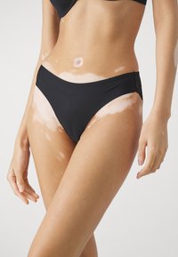 Costum de baie negru, partea de jos, cu o textură netedă, având accente din dantelă pe laterale și o croială joasă. Piele cu un model distinct de vitiligo vizibil.