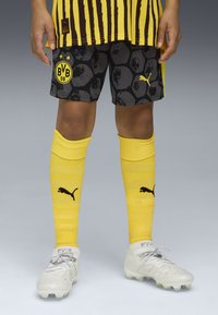 Jersey sepak bola yang menampilkan garis-garis kuning dan hitam, celana pendek hitam dengan pola tekstur, dan kaus kaki kuning dengan logo, dipasangkan dengan sepatu putih.