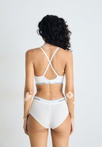 Kvinne med vitiligo som har på seg en hvit Calvin Klein-bh med kryssede stropper og matchende høyt liv undertøy, stående mot en ensfarget bakgrunn.