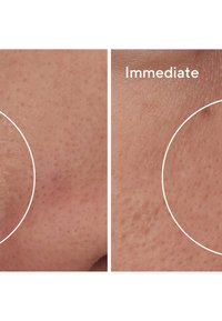 Murad TARGETED PORE CORRECTOR - Dagkräm