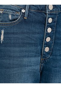Donkerblauwe denim jeans met een knoopsluiting met vijf zilveren knopen, slijtagelijnen aan de voorkant en contrasterende stiksels.