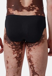 Schwarze Schwimmshorts an einem menschlichen Modell mit unregelmäßiger Hautpigmentierung, mit glattem Material und passgenauer Schnittführung.
