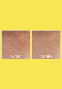 Images avant et après montrant une amélioration de la texture de la peau. À gauche, le teint est visiblement irrégulier, tandis qu'à droite, il est plus uniforme et lisse.
