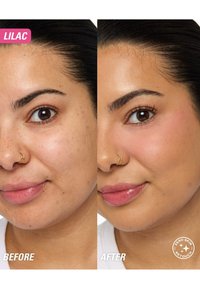 Närbild av ett ansikte som visar huden före och efter behandling. Den vänstra sidan visar en ojämn ton, medan den högra sidan verkar jämnare och ljusare.