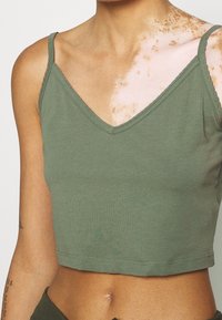 Donna con un top corto verde, che mostra tonalità di pelle chiare e scure con vitiligine sulla spalla e sulla parte superiore del petto.