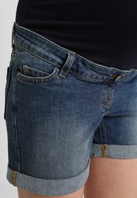 Bermudas de ganga em azul escuro com uma textura desbotada, barra rolada, design de cinco bolsos e detalhes em costura amarela.