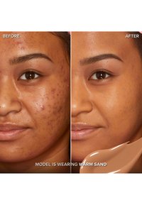 Comparaison avant-après montrant la peau du visage. À gauche : texture irrégulière, marques rouges d'acné. À droite : texture plus lisse, teint uniforme, présenté avec un échantillon de teinte sable chaude.