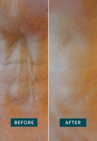 Deux images côte à côte montrent des textures de peau, à gauche avec des tons inégaux et des lignes marquées, à droite plus lisse avec des imperfections réduites.