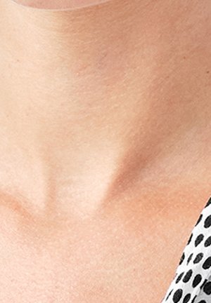 Gros plan sur le cou et le haut de la poitrine d'une personne à peau claire, avec un vêtement à pois noirs et blancs visible sur le côté droit.