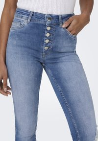 Magas derekú, koptatott kék farmernadrág. Öt gombos záródás, elülső zsebek, és enyhe kopás a lábon. Slim fit.