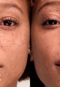 Dos vistas en primer plano de un rostro, mostrando la textura de la piel con pecas, un lado más claro que el otro. Pendientes visibles en el lado izquierdo.