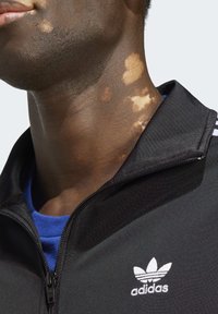 Svart zip-up jacka med vit Adidas-logga. Blå skjorta under. Huden visar fläckar av ljusare färg. Fokusera på nacke och övre torso.