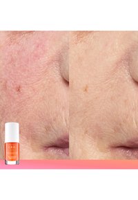 Produkt pielęgnacyjny C.E.O. w pomarańczowej butelce z białą nakrętką. Zbliżenie na skórę przed i po aplikacji, pokazujące poprawę struktury i kolorytu.