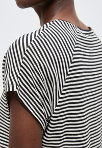 Κοντινό πλάνο ατόμου που φοράει ασπρόμαυρο ριγέ κοντομάνικο τοπ, εμφανίζοντας λεπτομέρειες του ώμου και του άνω μέρους της πλάτης.