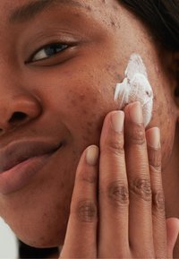 Moisturizing cream being applied to a skin with visible texture and blemishes. Cream is white, and the hand has natural nails.