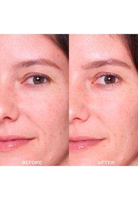 Zdjęcia porównawcze twarzy kobiety, pokazujące gładszą teksturę skóry i zredukowane niedoskonałości po prawej stronie, oznaczone "PRZED" i "PO".