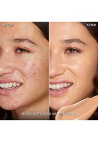 Comparaison avant-après de la peau ; à gauche, on voit de l'acné, tandis qu'à droite, la peau est claire avec une texture lisse. Teinte du produit étiquetée comme "Vanille".