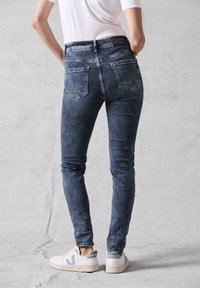 Jeans de mezclilla ajustados de color azul oscuro con textura deslavada, cinco bolsillos y una etiqueta verde en la cintura, combinados con zapatillas blancas.