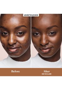 Comparativa facial de una mujer que muestra acné y manchas oscuras antes, y una piel más clara y suave después de usar el producto de cuidado de la piel etiquetado como 5W Eclair.