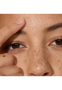 Nærbilde av en panne med synlige fregner og en hudblemme. En hånd berører huden forsiktig. Naturlige toner og jevn tekstur er tydelig.