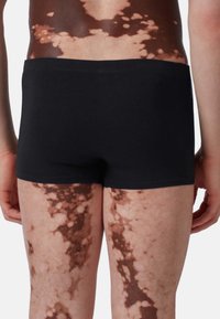 Boxer di colore nero, realizzati in un tessuto liscio, si posizionano appena sopra le cosce, evidenziando un motivo cutaneo texturizzato e marmorizzato sulle gambe.