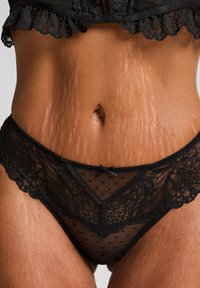 Close-up van de buik en heupen met zichtbare striae, gekleed in zwarte kanten lingerieset met decoratieve randen en een klein strikje op de slip.