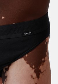 Primo piano di pelle scura con vitiligine che indossa un perizoma nero della marca Skiny sull'anca e parte superiore della coscia.