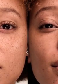 Due ritratti in primo piano affiancati di un volto con lentiggini prominenti, caratterizzato da una pelle texturizzata, occhi scuri e capelli ricci e corti.