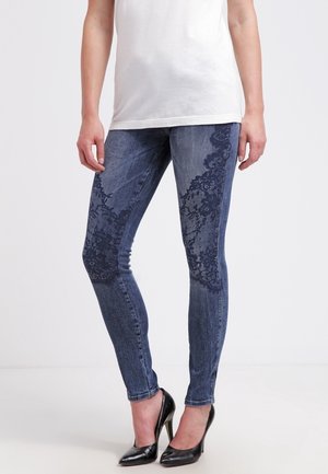 Vrouw draagt blauwe skinny jeans met donkere bloemen kanten patronen op de dijen en zwarte hoge hakken, staand tegen een effen achtergrond.