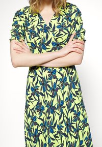 Donna in un vestito giallo con un motivo floreale blu e nero, braccia incrociate in vita, su uno sfondo bianco uniforme.