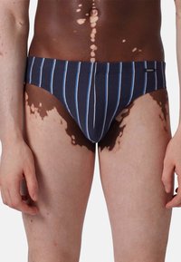 Torso maschile e parte superiore delle gambe con vitiligine, indossante slip blu navy con strisce verticali bianche e azzurro chiaro.