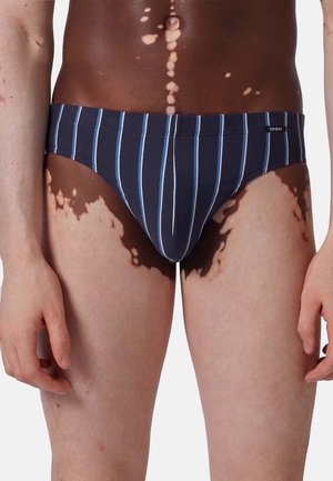 Männlicher Oberkörper und Oberschenkel mit Vitiligo, der marineblaue Unterhosen mit weißen und hellblauen vertikalen Streifen trägt.