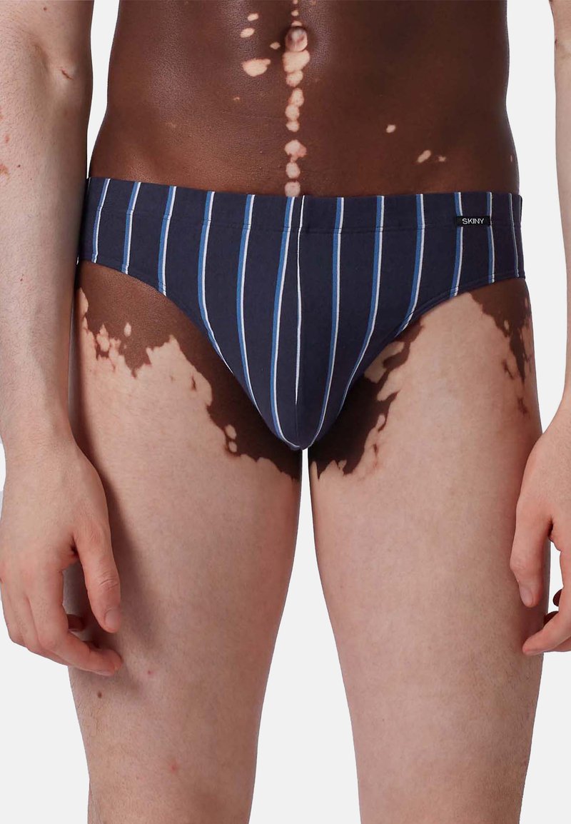 Torso maschile e parte superiore delle gambe con vitiligine, indossante slip blu navy con strisce verticali bianche e azzurro chiaro.