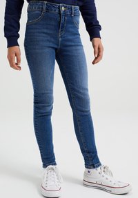 Modri traperje skinny jeans imajo visok pas, kontrastno rumeno šivanko in pet žepov. Kombinirani z belimi platnenimi supergami.