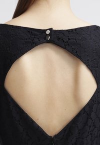Schwarzes Spitzenkleid mit einem rautenförmigen Ausschnitt auf dem Rücken, gesichert mit zwei silbernen Knöpfen. Glatte Haut ist durch den Ausschnitt sichtbar.
